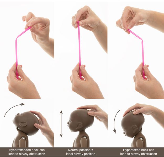 Positional Asphyxiation