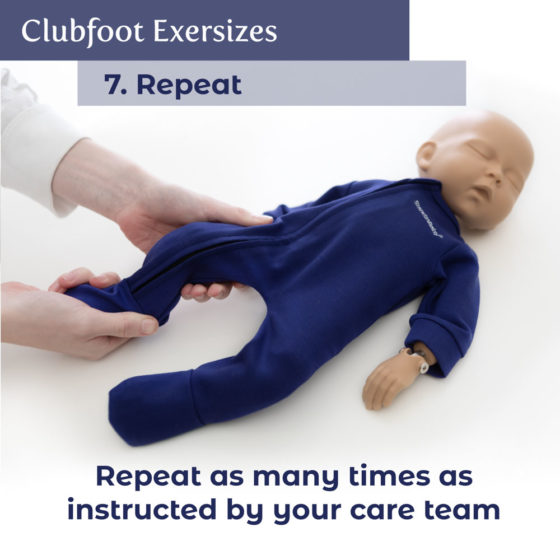 Clubfoot Exercises - StandInBaby®